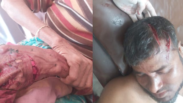 বাঁশখালীতে বাড়ীর সীমানা বিরোধে হামলার ঘটনায় নারীসহ আহত দুই