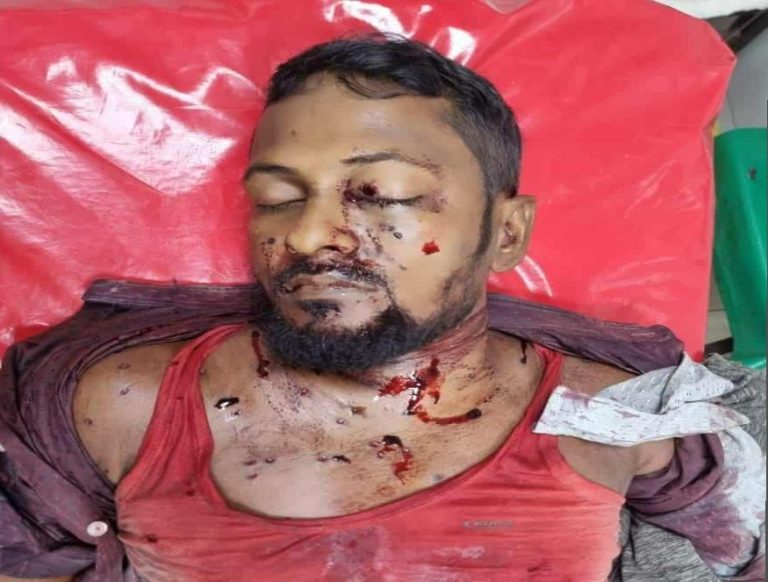 চকরিয়ায় চিংড়ি ঘেরে আধিপত্য বিস্তারে সংঘর্ষে নিহত ১