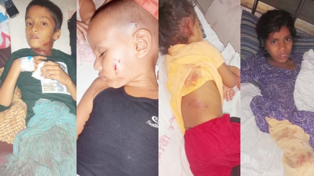 বাঁশখালীতে পাগলা কুকুরের কামড়ে ৫ শিশু-নারী আহত, আতঙ্কে এলাকাবাসী